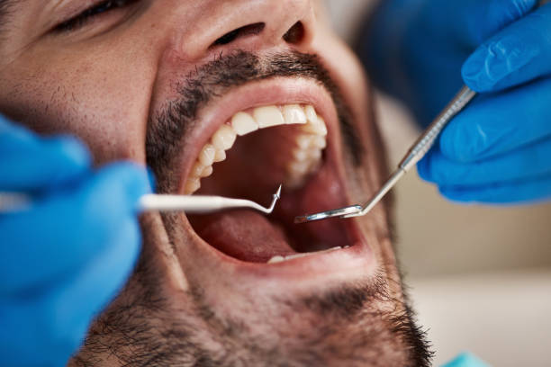 Best Emergency Dental Care for Trauma or Injury in Lackawanna, NY